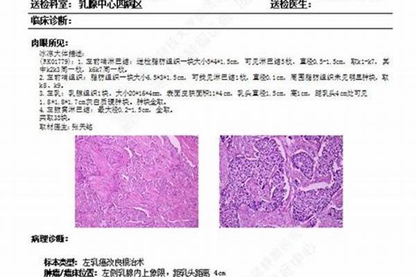 活检病理报告单应该怎么看